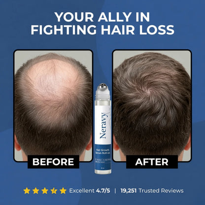 Neravy Hair Growth Roll on Serum